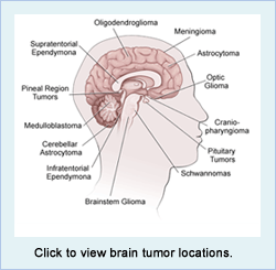 Brain Tumor Locations
